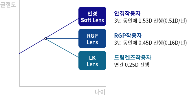 드림렌즈 장점
